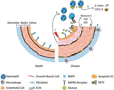 The Role of Neutrophils and Neutrophil Elastase in Pulmonary Arterial Hypertension